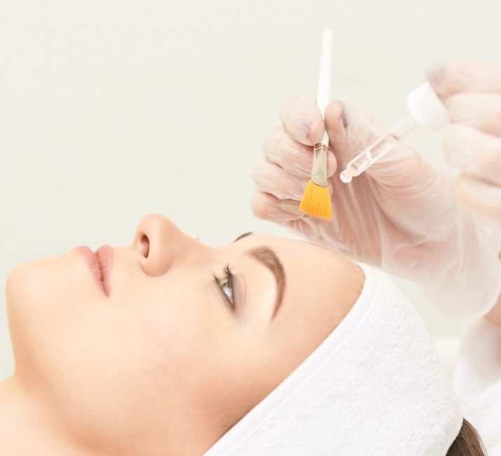 chemicalpeeling chemicalpeeling